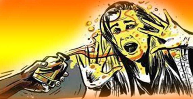 Assam: Acid attack on minor girl in Barpeta
