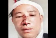 Sikkim Man Called 'Chinese' and Brutally beaten by Miscreants In Bengaluru