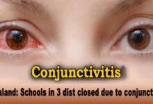 Nagaland: Schools in Dimapur, Chumoukedima and Nuiland closed due to conjunctivitis outbreak