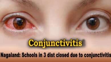 Nagaland: Schools in Dimapur, Chumoukedima and Nuiland closed due to conjunctivitis outbreak