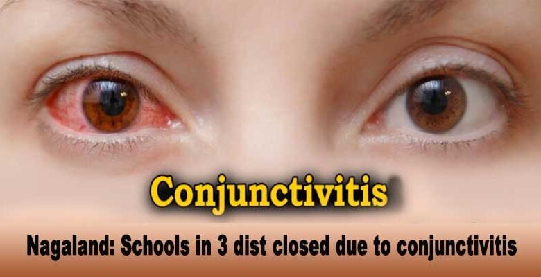 Nagaland: Schools in Dimapur, Chumoukedima and Nuiland closed due to conjunctivitis outbreak
