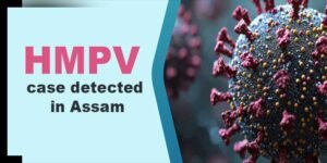 HMPV case detected in Assam; 10-month-old tests positive in AMCH
