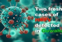 Assam: Two fresh cases of HMPV detected in Guwahati