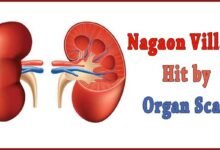 Assam Police Bust Kidney Racket in Nagaon