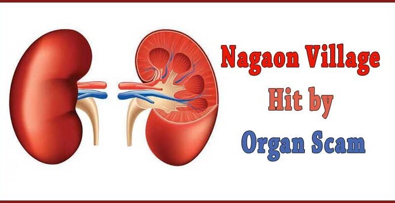 Assam Police Bust Kidney Racket in Nagaon
