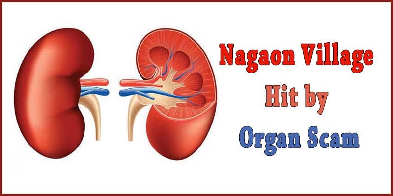 Assam Police Bust Kidney Racket in Nagaon
