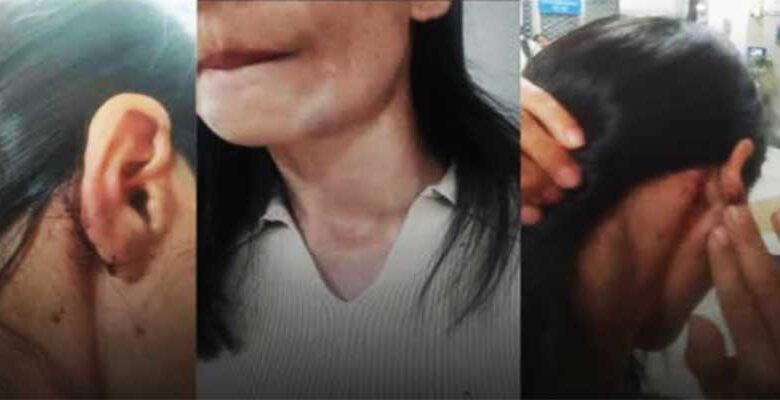 Two Minors Held Over Assault on Manipur Woman in Delhi