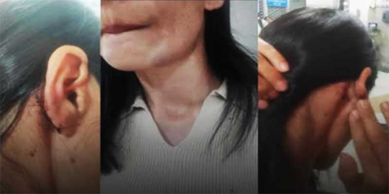 Two Minors Held Over Assault on Manipur Woman in Delhi